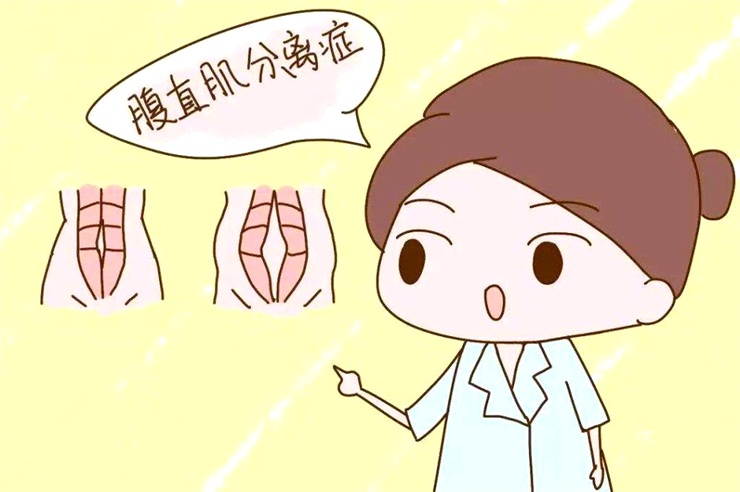 腹直肌分離問題，產(chǎn)后康復(fù)治療儀幫助您