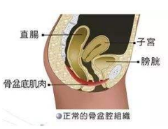 產(chǎn)后盆底肌怎么修復(fù)？你得做好盆底功能檢測(cè)