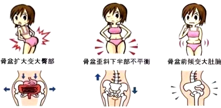 盆底康復(fù)治療怎么做，盆底治療儀是關(guān)鍵點