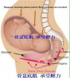 產(chǎn)后盆底康復(fù)治療開始后，出現(xiàn)陰道出血怎么破？