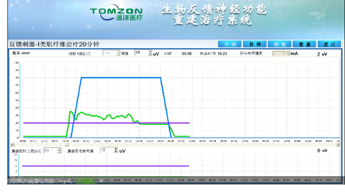 盆底康復(fù)治療怎么做？盆底康復(fù)治療肌電生物反饋治療儀的機(jī)理是什么？
