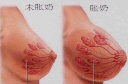 母乳分析和檢測儀器，教你如何緩解漲奶？