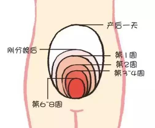 產(chǎn)后康復，什么叫子宮復舊不良？