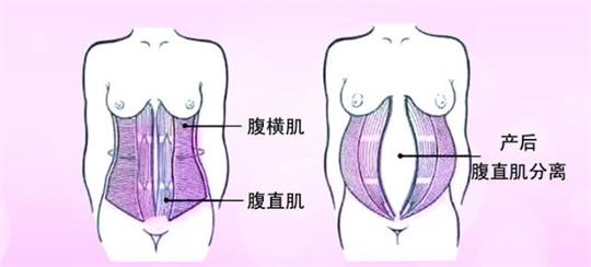 產(chǎn)后修復(fù)中心小型變大型，母乳分析儀器是專業(yè)性的體現(xiàn)