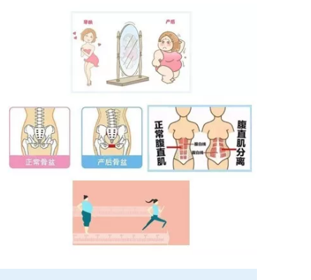 為什么便攜式產(chǎn)后康復(fù)治療儀能被這么多產(chǎn)后修復(fù)中心接受？這就是原因