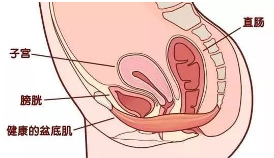 除了腹直肌修復，盆底康復也得重視，恢復好身材