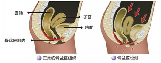 盆底功能檢測很重要，盆底肌松弛了會(huì)有什么表現(xiàn)呢？