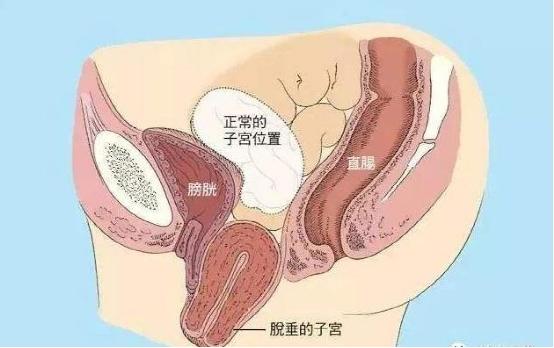 產后康復是否可以選擇儀器？