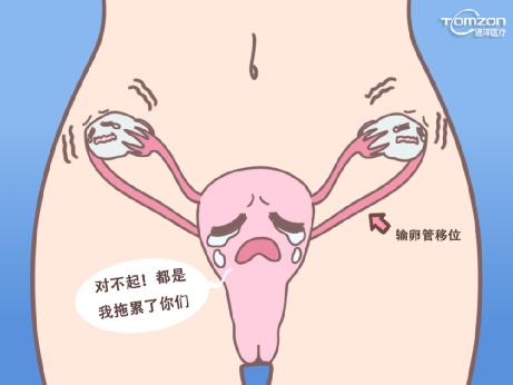 盆底康復治療儀有哪些常見的效果？