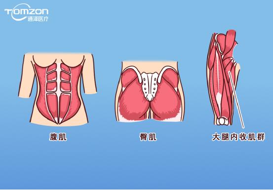 凱格爾運動該怎么做？盆底肌修復儀器還能用嗎？