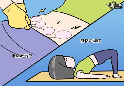 便秘的病因考慮下盆底肌，有問題用盆底肌修復(fù)儀器治療