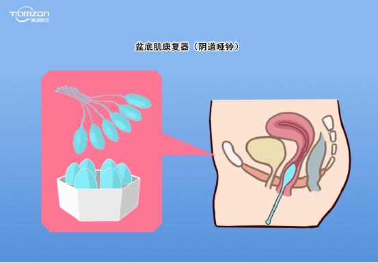 如有盆底高張者，不做力量提升型運(yùn)動(dòng)，否則容易加重盆底損傷。建議在做盆底康復(fù)運(yùn)動(dòng)前，先進(jìn)行盆底肌肉檢測(cè)