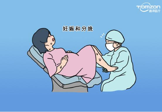 盆底康復治療儀是否可以促進盆底肌肉康復？