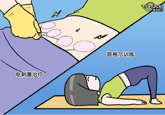 產(chǎn)后便秘怎么辦？盆底肌修復(fù)儀器來治療