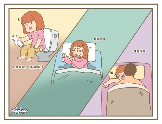 使用盆底肌康復儀必要嗎？